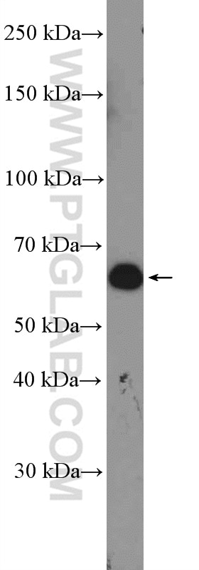 Western Blot (WB) analysis of mouse brain tissue using RAP1GDS1 Polyclonal antibody (10377-1-AP)