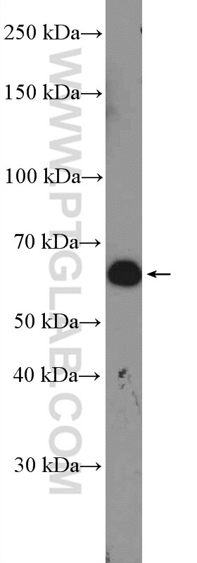 WB analysis of mouse brain using 10377-1-AP