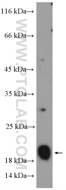 Western Blot (WB) analysis of HeLa cells using RAP2A Polyclonal antibody (13789-1-AP)