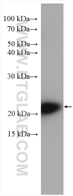 WB analysis of mouse lung using 13789-1-AP