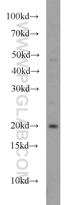 Western Blot (WB) analysis of K-562 cells using RAP2A Polyclonal antibody (13789-1-AP)