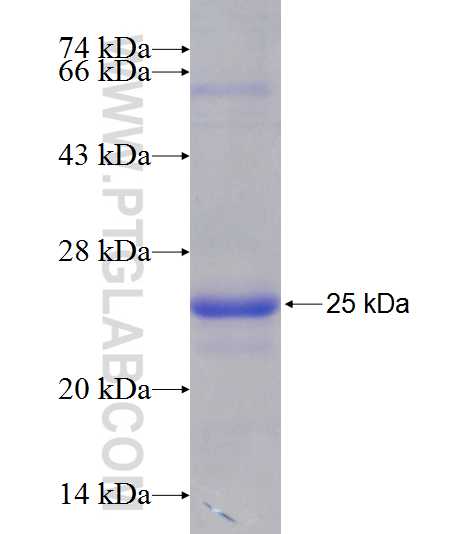 RAP2B fusion protein Ag9651 SDS-PAGE