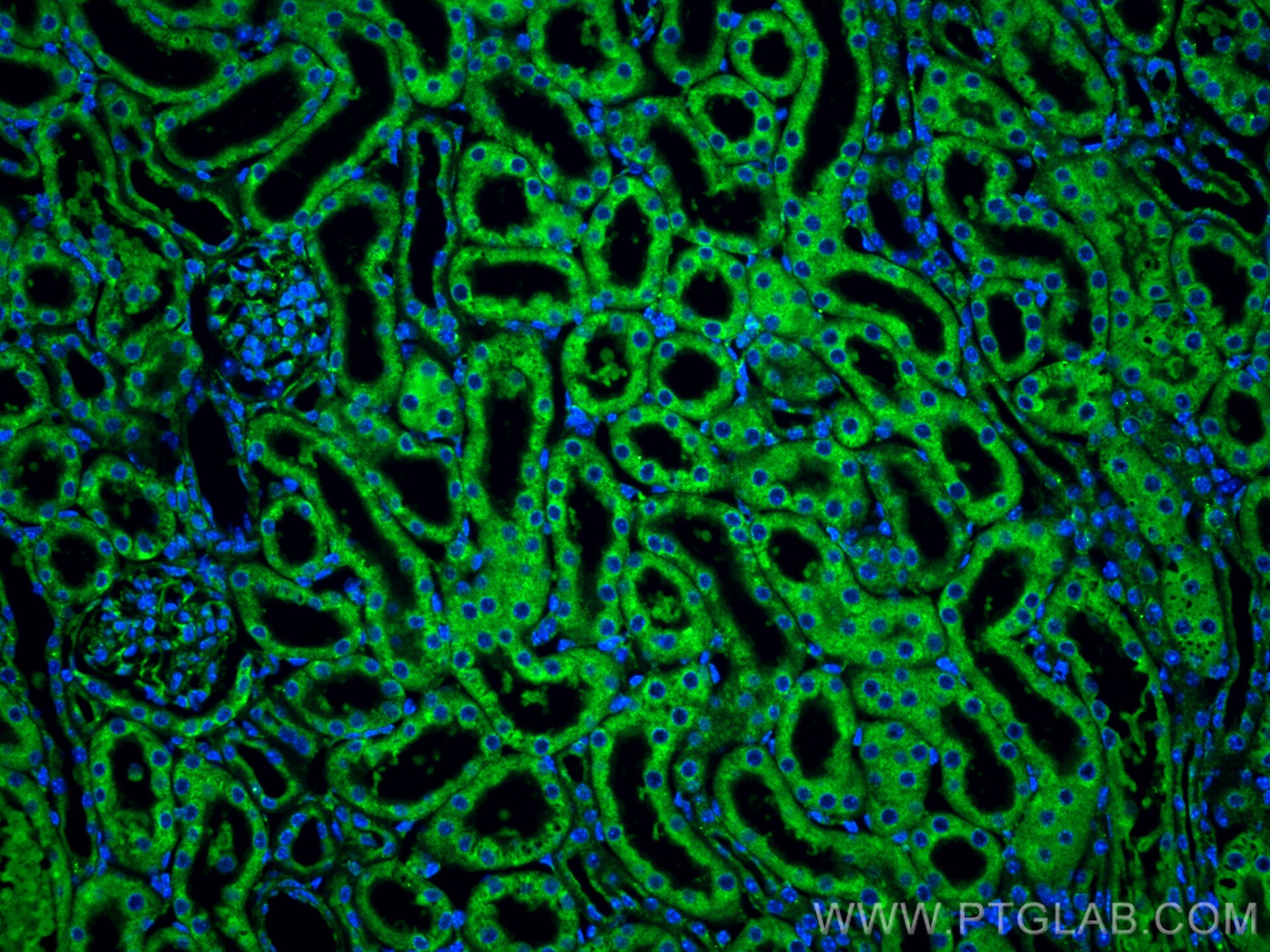 Immunofluorescence (IF) / fluorescent staining of mouse kidney tissue using RAPGEF2 Polyclonal antibody (31299-1-AP)