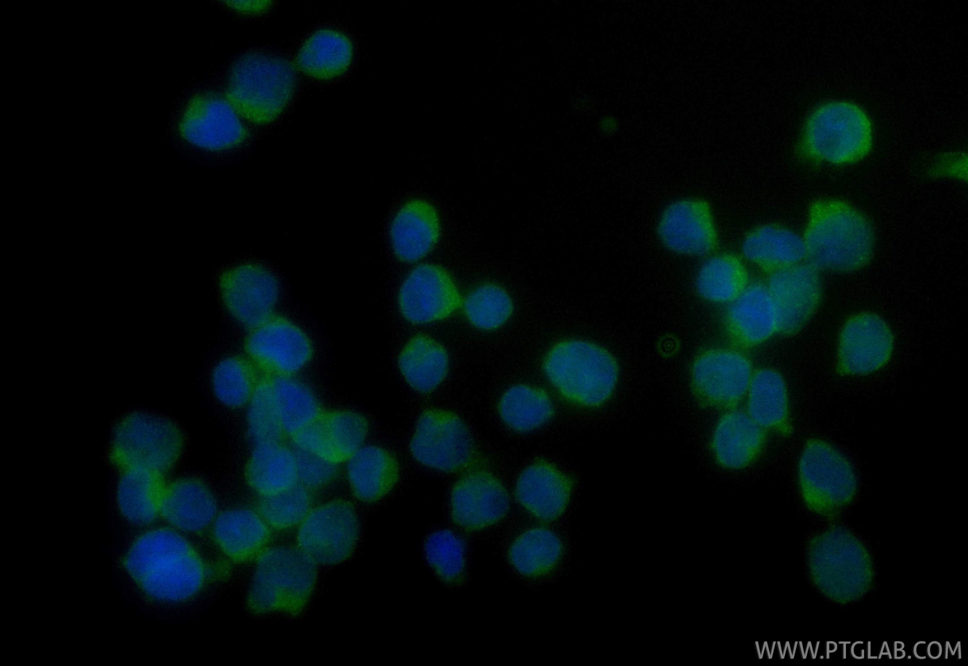 Immunofluorescent analysis of (4% PFA) fixed Jurkat cells using CoraLite® Plus 488 RAPGEF2 antibody (CL488-84331-4, Clone: 241637G5 ) at dilution of 1:200. Immunofluorescence (IF) / fluorescent staining of Jurkat cells using CoraLite® Plus 488-conjugated RAPGEF2 Recombinant (CL488-84331-4)