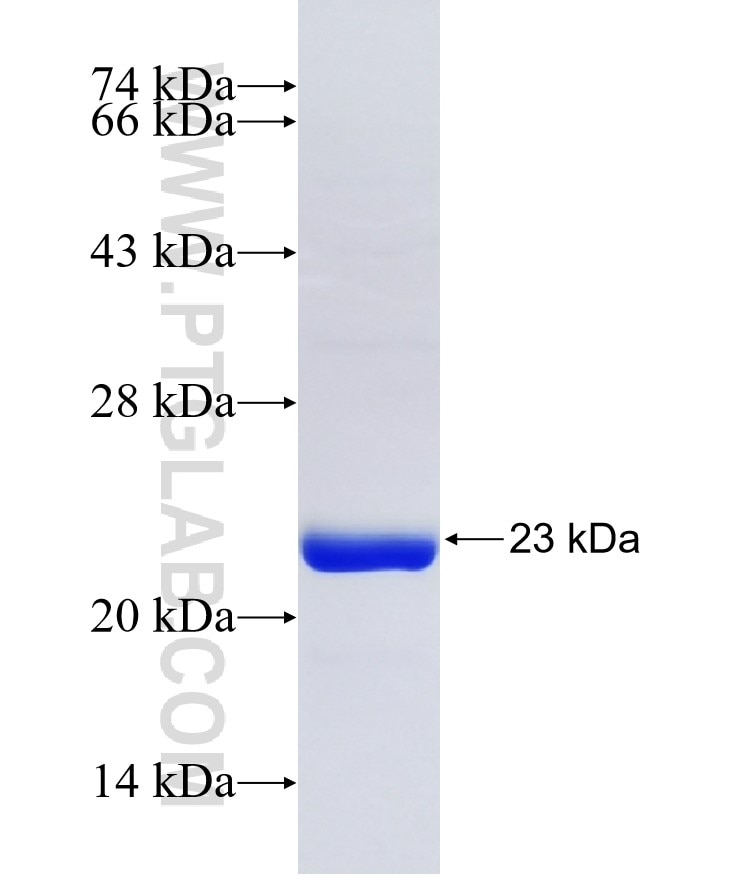 RAPGEF2 fusion protein Ag35334 SDS-PAGE RAPGEF2 fusion protein Ag35334 SDS-PAGE
