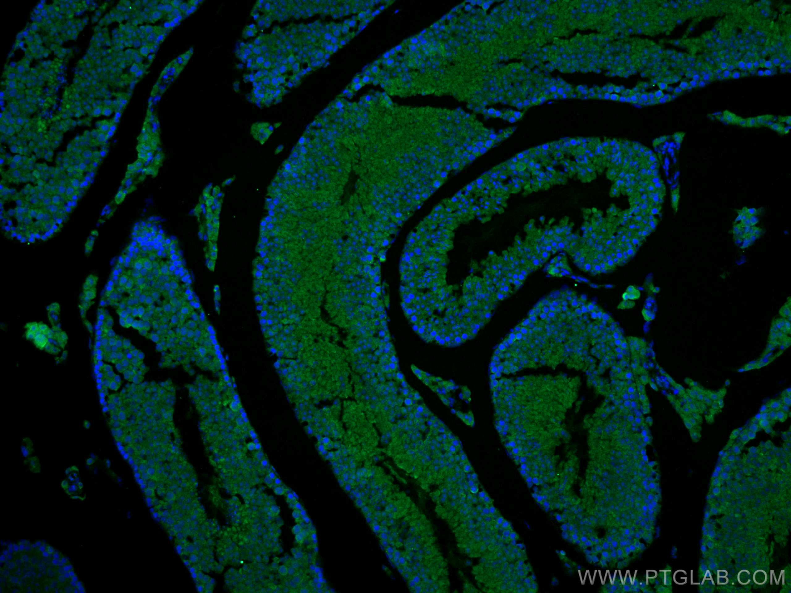 Immunofluorescence (IF) / fluorescent staining of mouse testis tissue using EPAC1 Polyclonal antibody (12572-1-AP)