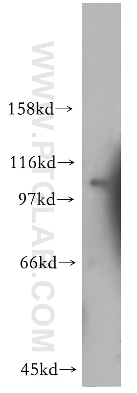 Western Blot (WB) analysis of human cerebellum tissue using EPAC2 Polyclonal antibody (13882-1-AP)