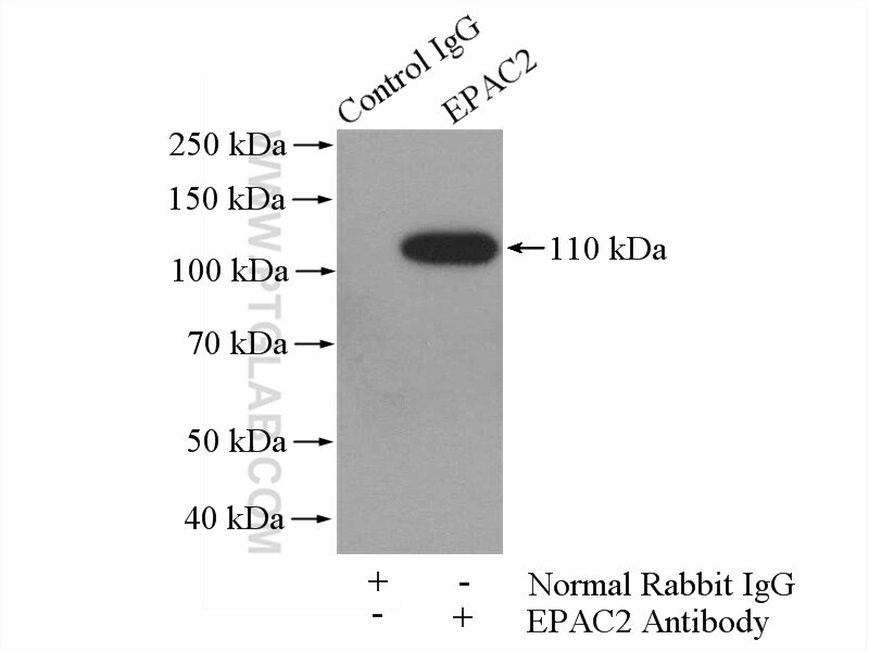 Immunoprecipitation (IP) experiment of mouse brain tissue using EPAC2 Polyclonal antibody (19103-1-AP)