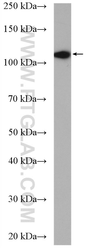 Western Blot (WB) analysis of mouse brain tissue using EPAC2 Polyclonal antibody (19103-1-AP)