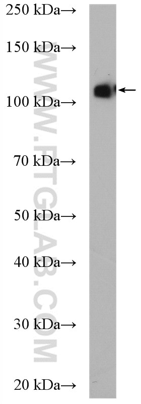 Western Blot (WB) analysis of rat brain tissue using EPAC2 Polyclonal antibody (19103-1-AP)