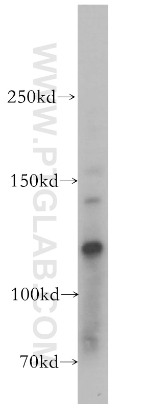 Western Blot (WB) analysis of HepG2 cells using EPAC2 Polyclonal antibody (19103-1-AP)