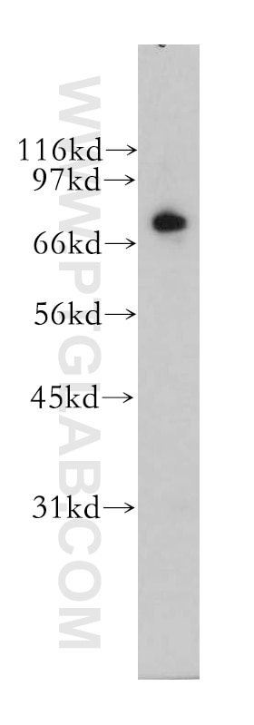 Western Blot (WB) analysis of human brain tissue using RAPGEF5 Polyclonal antibody (12556-1-AP)