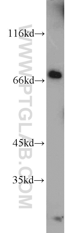 Western Blot (WB) analysis of human brain tissue using RAPGEF5 Polyclonal antibody (12556-1-AP)