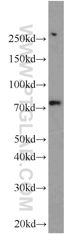 Western Blot (WB) analysis of mouse brain tissue using RAPGEF5 Polyclonal antibody (12556-1-AP)