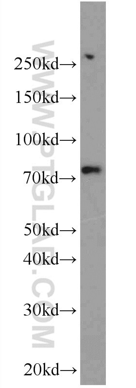 WB analysis of mouse brain using 12556-1-AP