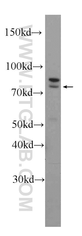 Western Blot (WB) analysis of HeLa cells using RAPGEF5 Polyclonal antibody (12556-1-AP)