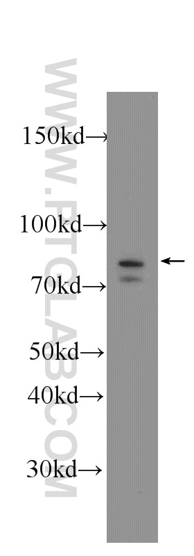 Western Blot (WB) analysis of K-562 cells using RAPGEF5 Polyclonal antibody (12556-1-AP)