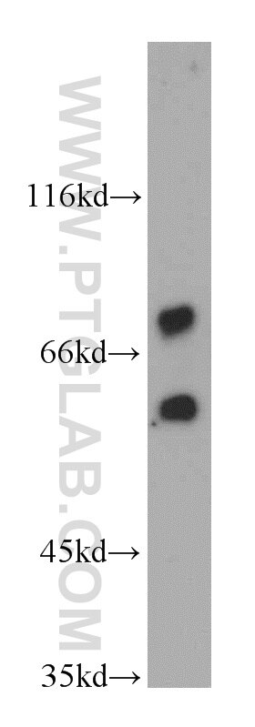 Western Blot (WB) analysis of human brain tissue using RAPGEFL1 Polyclonal antibody (21746-1-AP)
