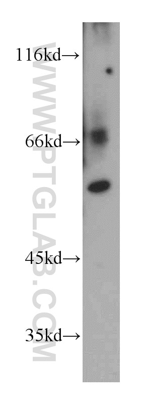 Western Blot (WB) analysis of mouse kidney tissue using RAPGEFL1 Polyclonal antibody (21746-1-AP)
