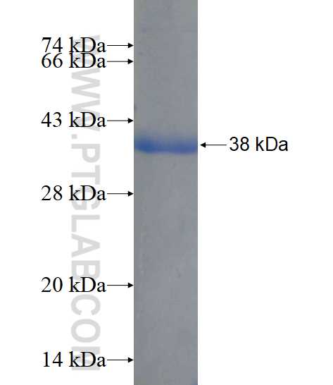 RAPGEFL1 fusion protein Ag16496 SDS-PAGE