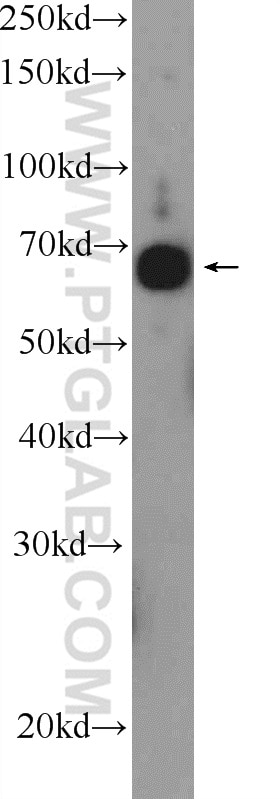 Western Blot (WB) analysis of SKOV-3 cells using RAPH1 Polyclonal antibody (25750-1-AP)