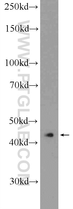 Western Blot (WB) analysis of Y79 cells using RAPSN Polyclonal antibody (20453-1-AP)