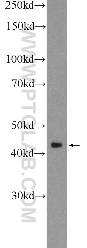 Western Blot (WB) analysis of Y79 cells using RAPSN Polyclonal antibody (20453-1-AP)