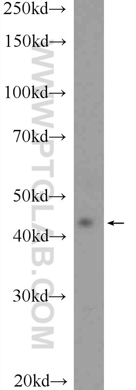 Western Blot (WB) analysis of Y79 cells using RAPSN Polyclonal antibody (20453-1-AP)