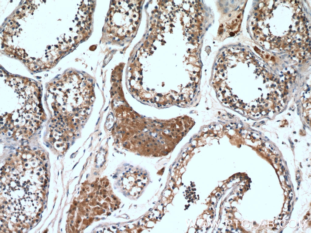 Immunohistochemistry (IHC) staining of human testis tissue using RARA Polyclonal antibody (10331-1-AP)