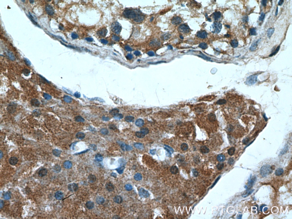 Immunohistochemistry (IHC) staining of human testis tissue using RARA Polyclonal antibody (10331-1-AP)