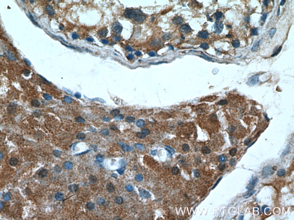 IHC staining of human testis using 10331-1-AP