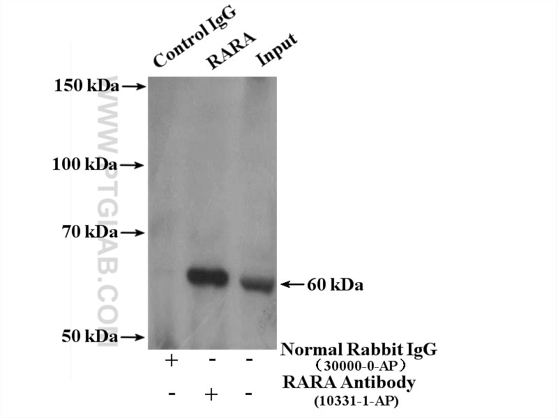 Immunoprecipitation (IP) experiment of HeLa cells using RARA Polyclonal antibody (10331-1-AP)