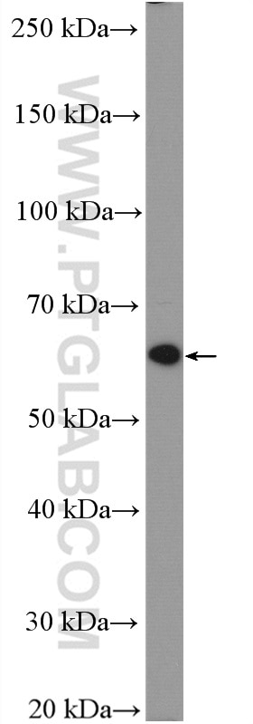 WB analysis of K-562 using 10331-1-AP