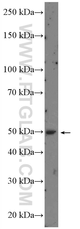 WB analysis of MCF-7 using 10331-1-AP