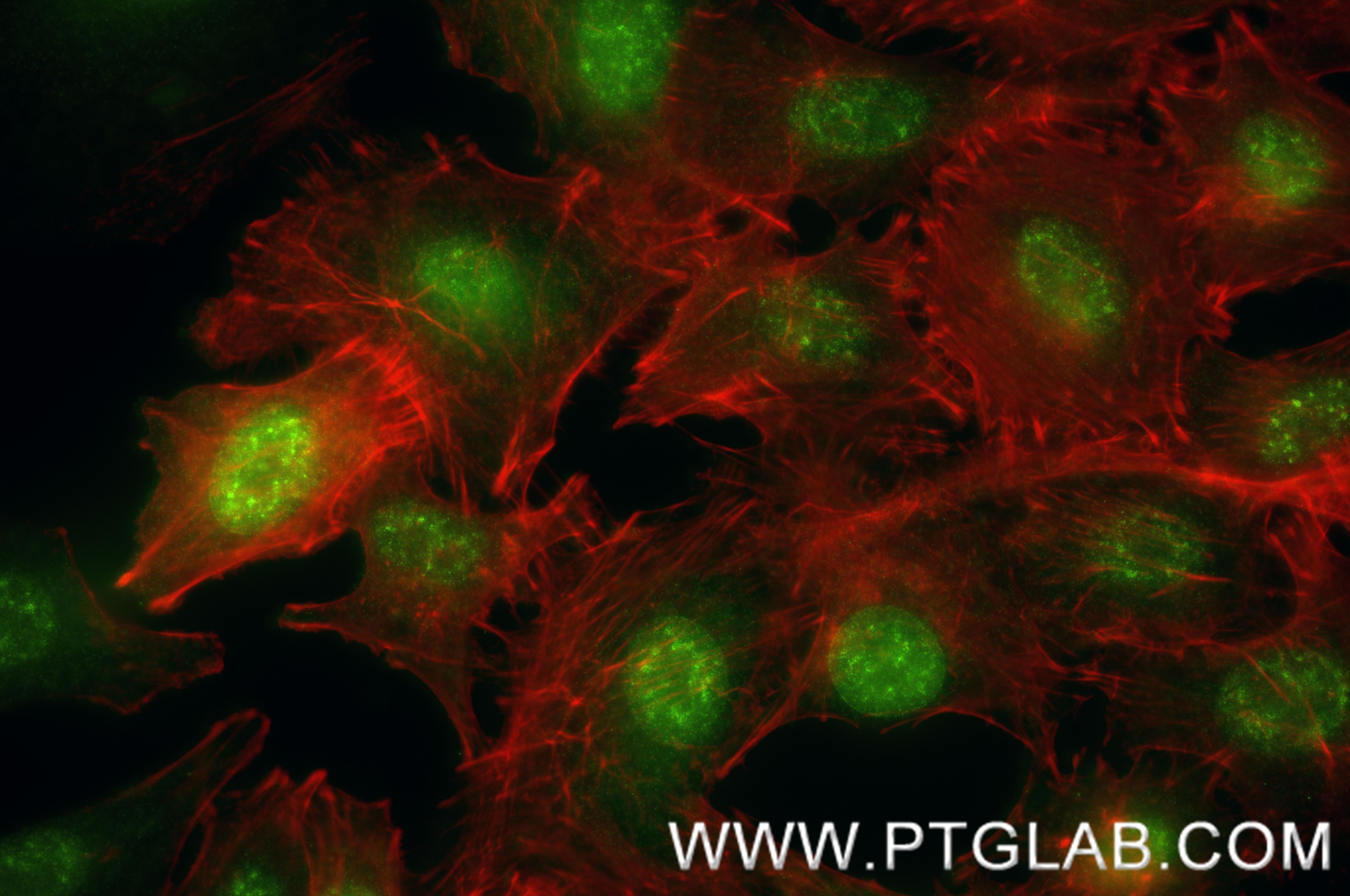 IF Staining of A549 using 88230-1-RR Immunofluorescence (IF) / fluorescent staining of A549 cells using RARA Recombinant monoclonal antibody (88230-1-RR)