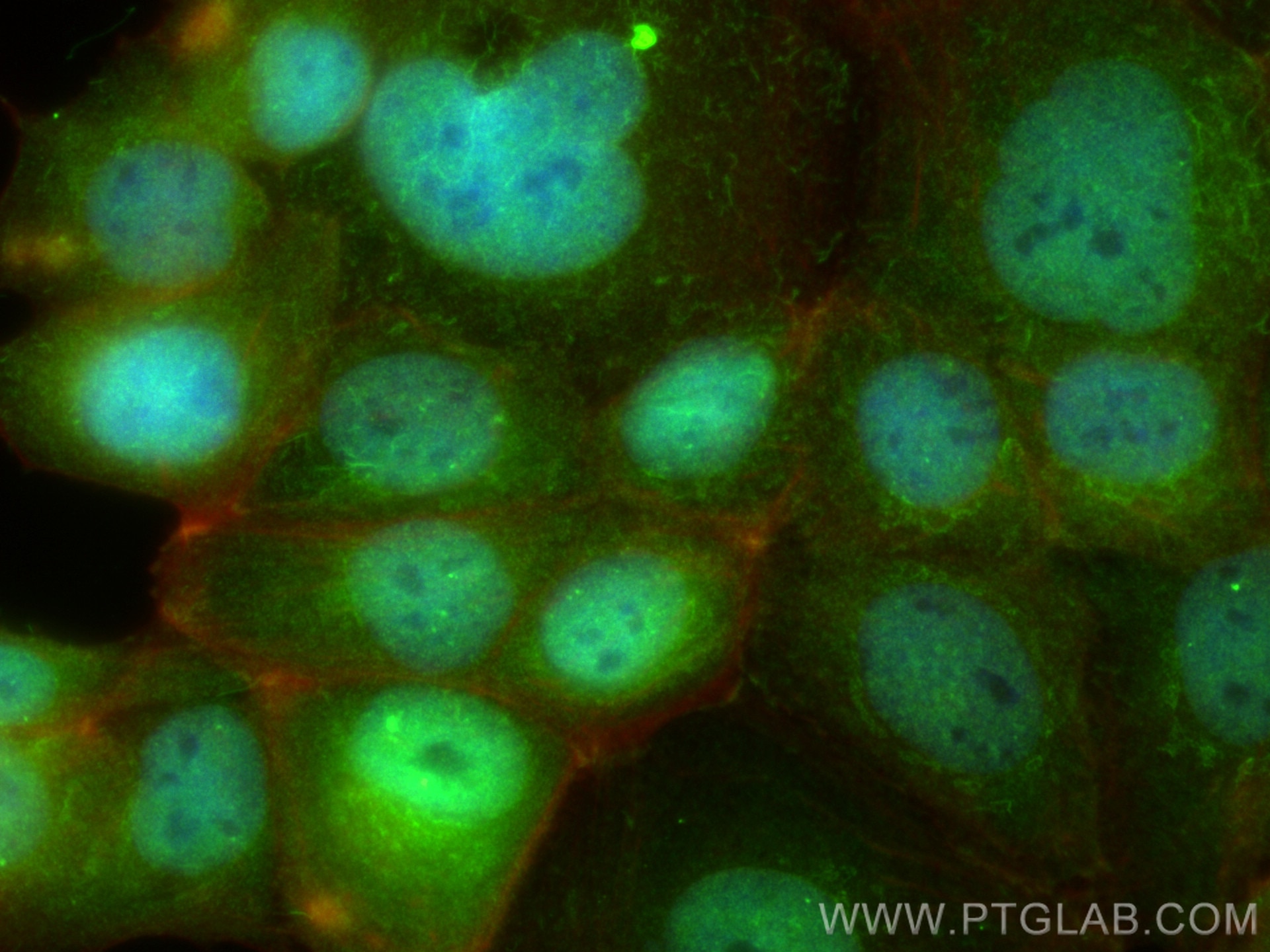 Immunofluorescence (IF) / fluorescent staining of MCF-7 cells using RARB Polyclonal antibody (14013-1-AP)