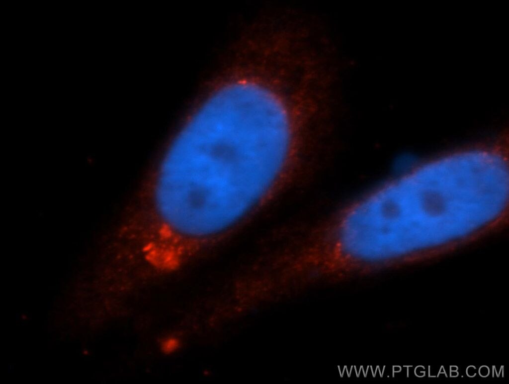 RARB Polyclonal antibody