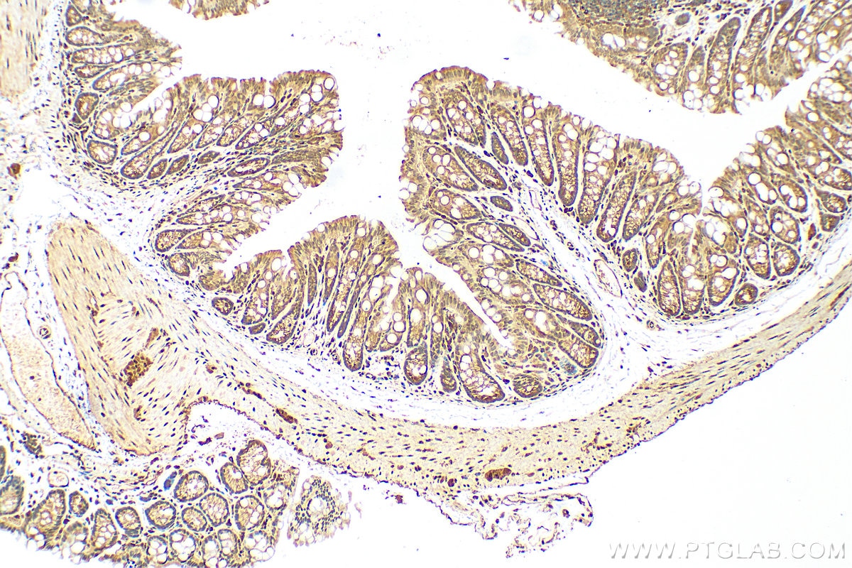 IHC staining of mouse colon using 14013-1-AP