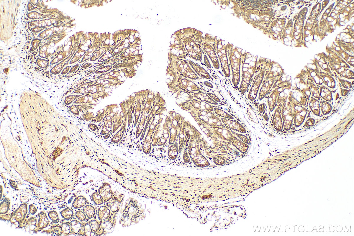 Immunohistochemistry (IHC) staining of mouse colon tissue using RARB Polyclonal antibody (14013-1-AP)