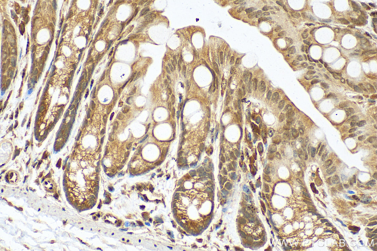 Immunohistochemistry (IHC) staining of mouse colon tissue using RARB Polyclonal antibody (14013-1-AP)