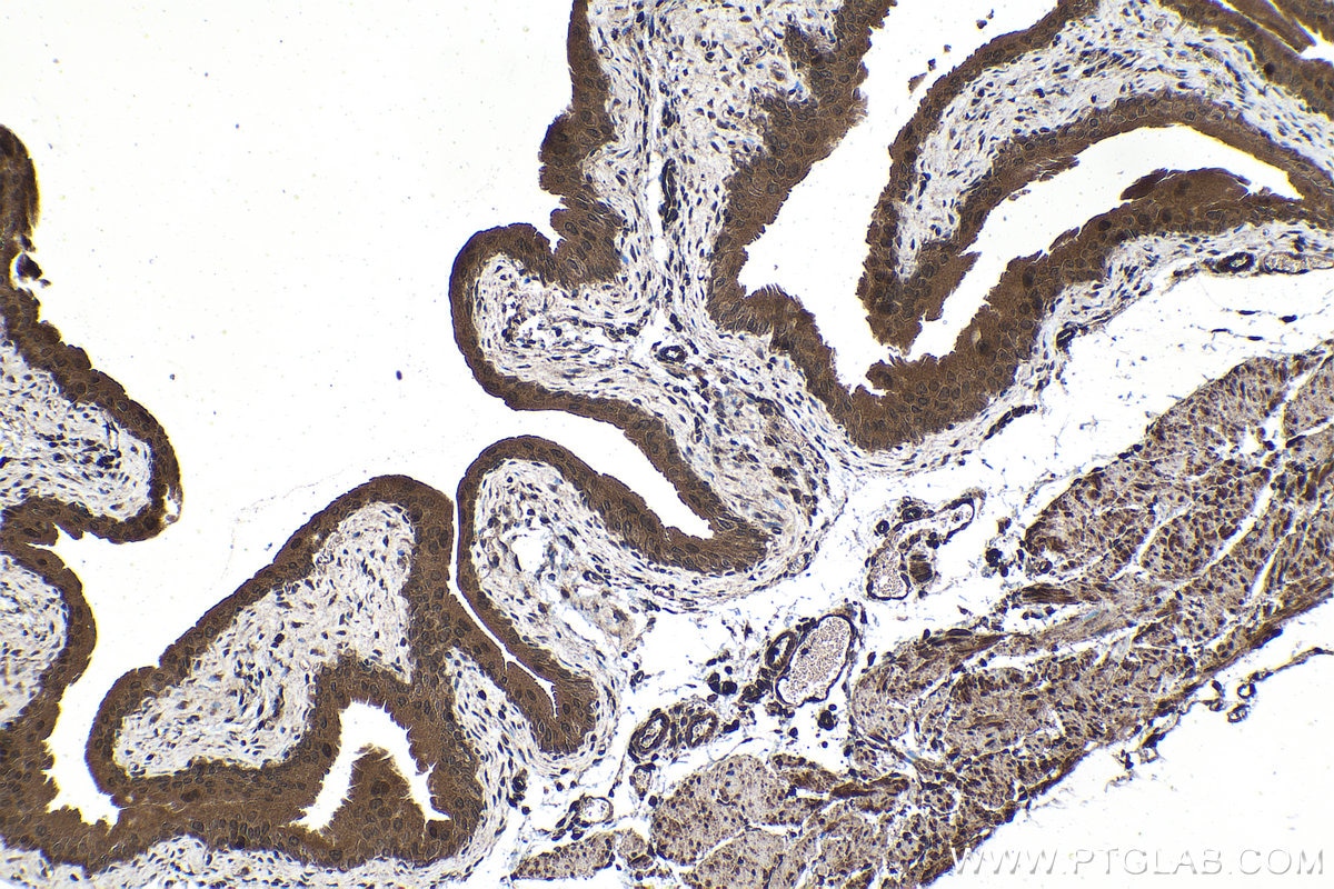 Immunohistochemistry (IHC) staining of mouse bladder tissue using RARB Polyclonal antibody (14013-1-AP)