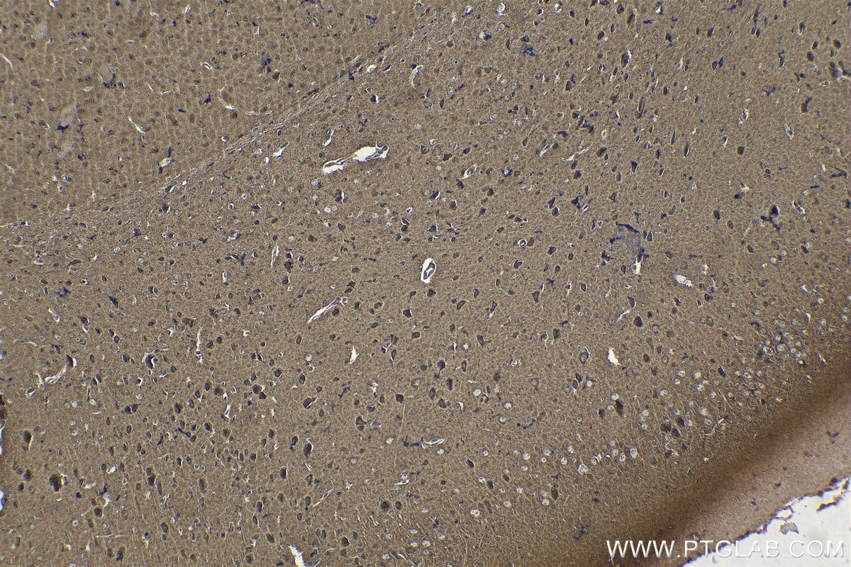 Immunohistochemistry (IHC) staining of mouse brain tissue using RARB Polyclonal antibody (14013-1-AP)