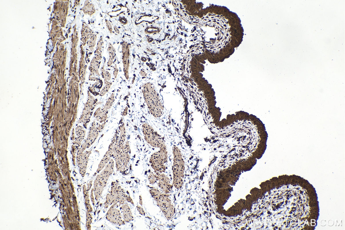 Immunohistochemistry (IHC) staining of rat bladder tissue using RARB Polyclonal antibody (14013-1-AP)