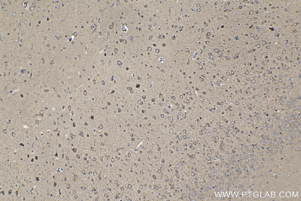 Immunohistochemistry (IHC) staining of rat brain tissue using RARB Polyclonal antibody (14013-1-AP)