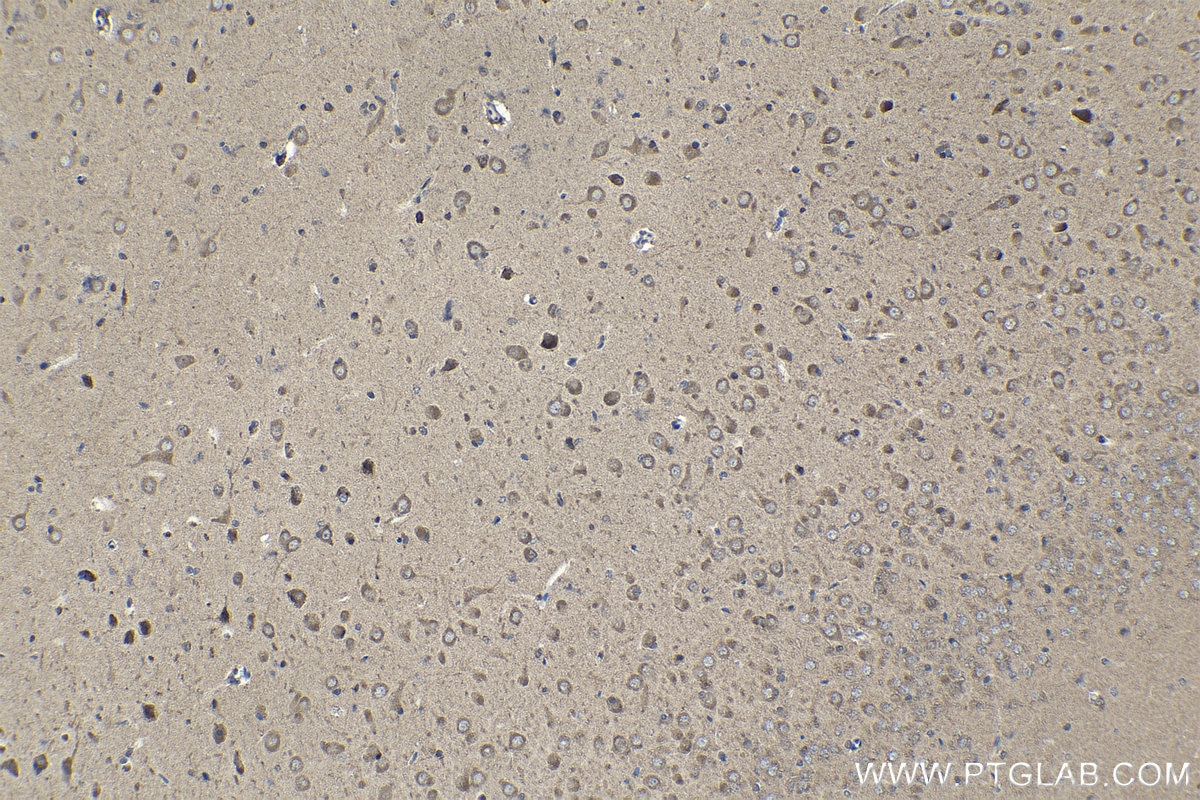 IHC staining of rat brain using 14013-1-AP