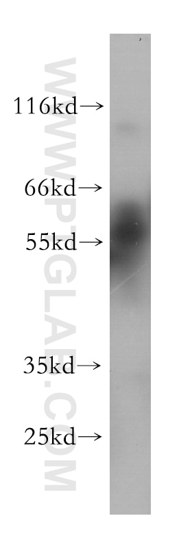 Western Blot (WB) analysis of MCF-7 cells using RARB Monoclonal antibody (60119-1-Ig)