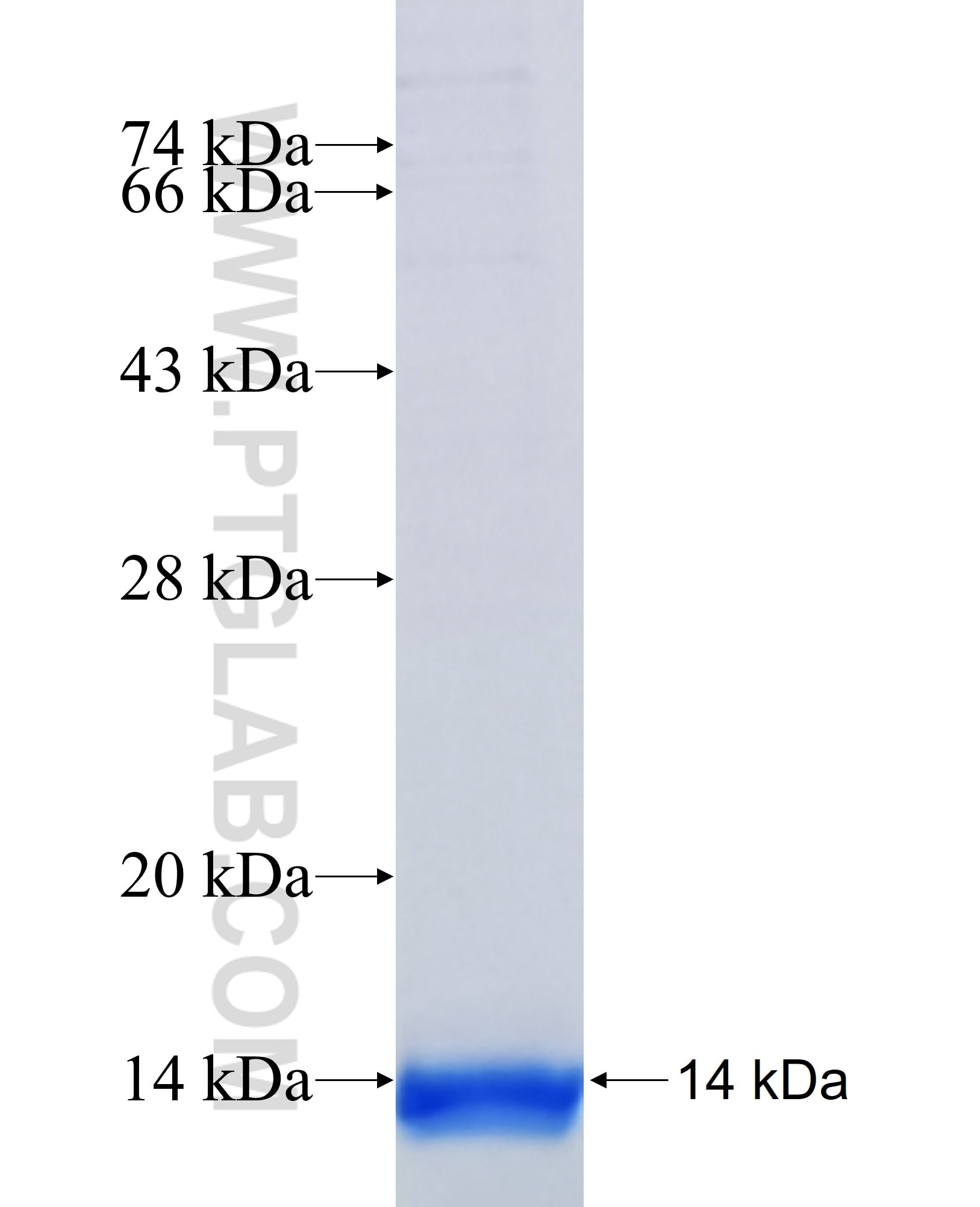 RARB fusion protein Ag39126 SDS-PAGE RARB fusion protein Ag39126 SDS-PAGE