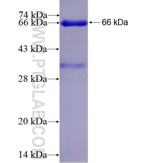 RARB fusion protein Ag5119 SDS-PAGE