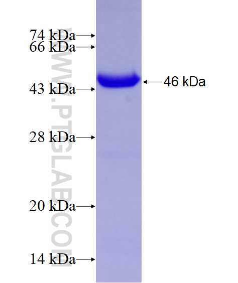 RARB fusion protein Ag6013 SDS-PAGE