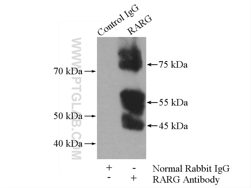 Immunoprecipitation (IP) experiment of MCF-7 cells using RARG Polyclonal antibody (11424-1-AP)